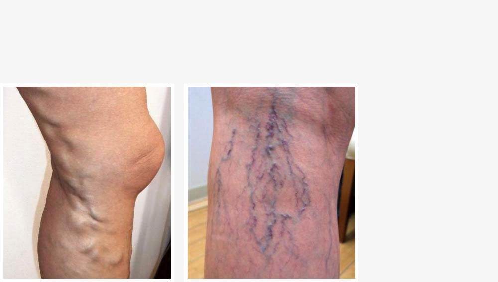 後藤内科医院 秋田県大仙市内科 呼吸器内科 循環器内科 小児科